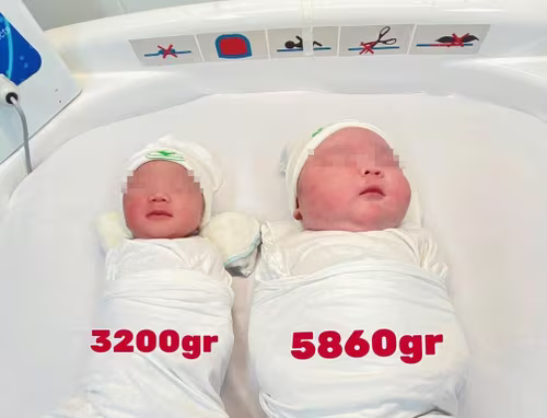 Ca sinh đặc biệt với bé trai chào đời nặng 5,4 kg